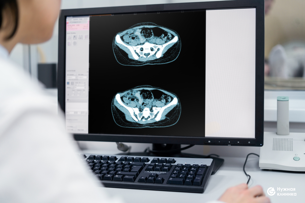 МРТ брюшной полости - Как проходит процедура МРТ?